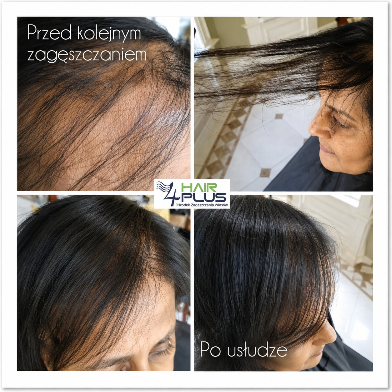 Efekt przed i po zagęszczeniu włosów metodą 4 Hair Plus