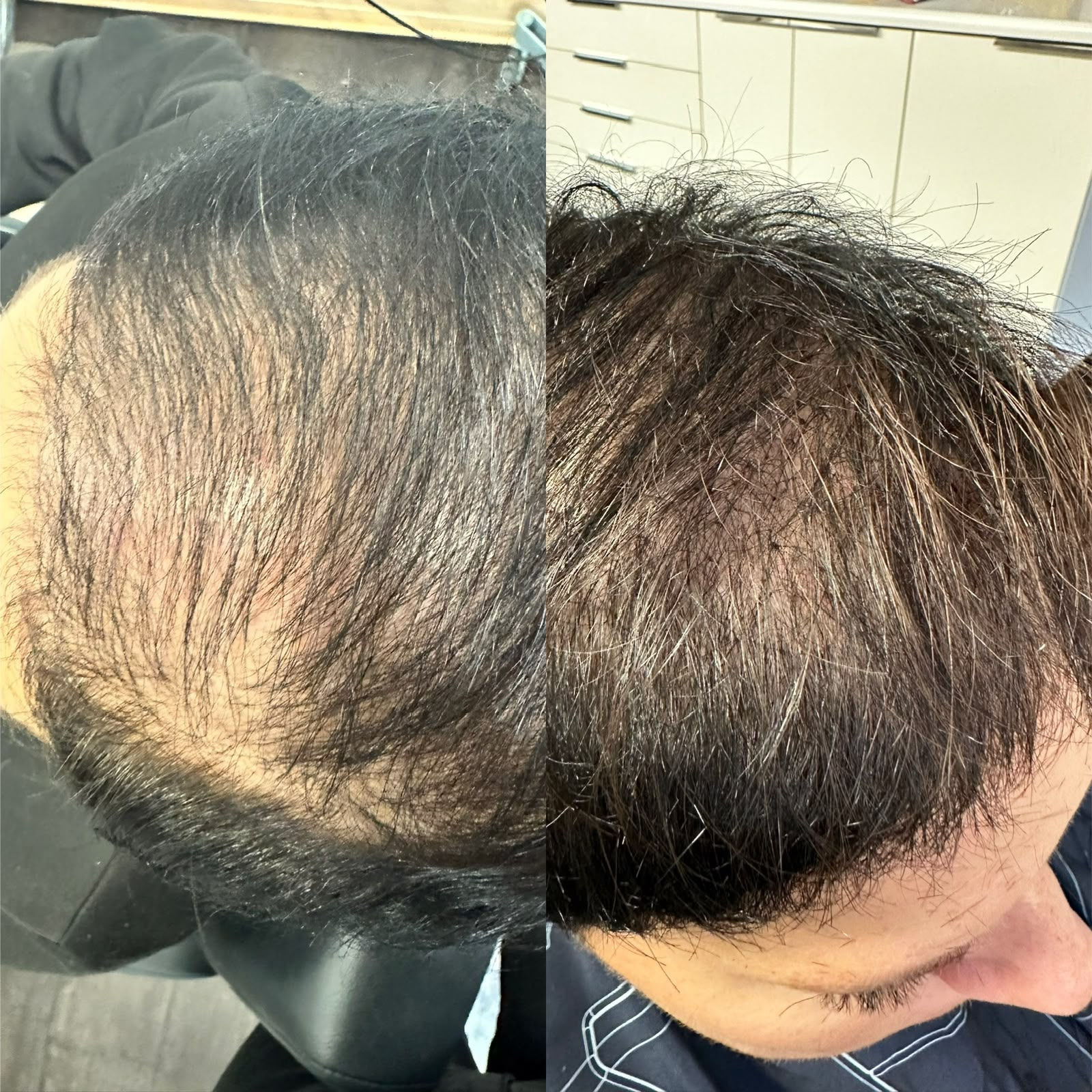 Efekt przed i po zagęszczeniu włosów metodą 4 Hair Plus